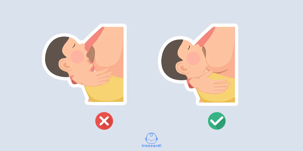 نحوه صحیح قرار دادن نوک سینه در دهان نوزاد