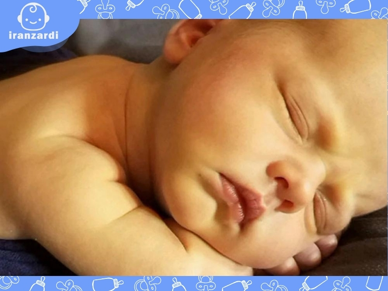 کرن ایکتروس نوزاد چیست؟ چگونه از آن جلوگیری کنیم؟